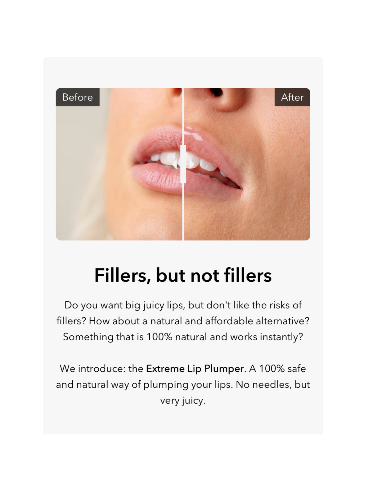 LIP INJECTION